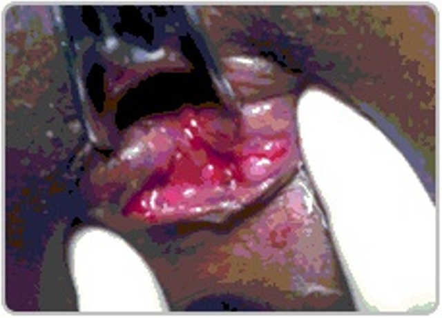 Dr.Kashid Hospital & Piles Clinic